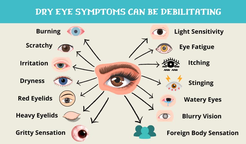 Dry eye symptoms