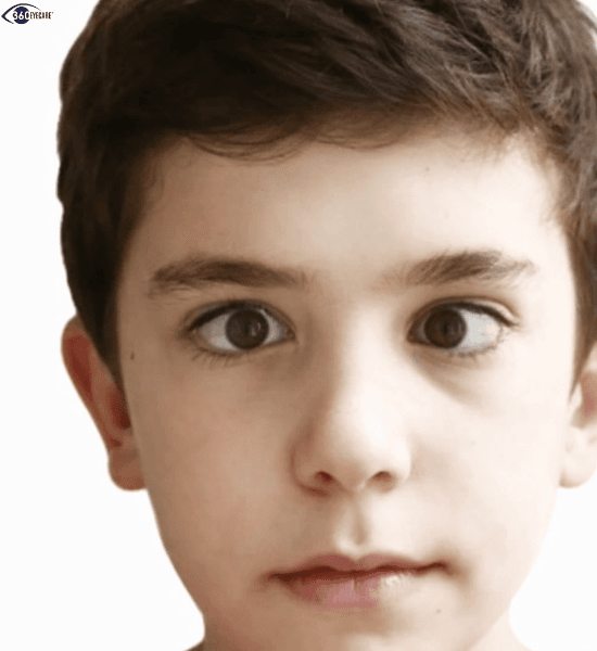 Pediatric eye care and amblyopia